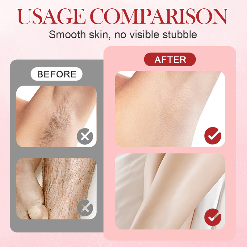 🎅Årets julegave er skjønnhet🌸Epilator med to hoder for kvinner, IPX7 vanntett